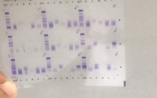sebia｜免疫固定电泳