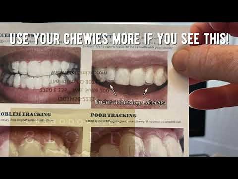 Welcome to Invisalign Treatment! | Orthodontist in Thornton, CO | Braces and Invisalign