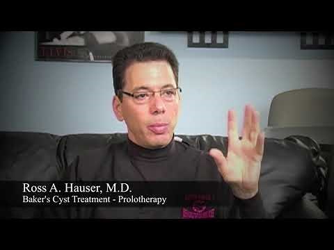 Baker's Cyst Treatment - Prolotherapy