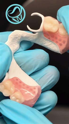 Peek Denture with 2-Unit Bridge for Dr. Amer #dentallab #dentist