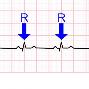 How to Calculate Heart-Rate from ECG - Learn more at https://acadoodle.com #emergencymedicine #intensivecare #respiratory #respiratorycare #icu #nurses #icunurse #ecg #ekg #cme #cmeonline | ECG Teacher