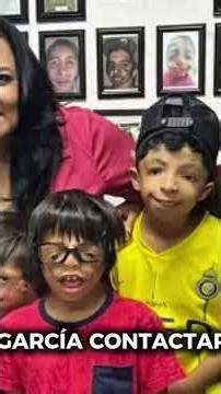 Treacher Collins es la enfermedad que tiene y fue apoyado en #Yucatán