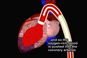 Cardiogenic Shock and Balloon Pump Video - Trial Image Inc.