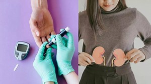 High blood sugar can be an early symptom of kidney disease: Causes, warning signs, and prevention tips