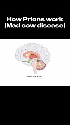 mcat.focus on Instagram: "Witness protein misfolding with devastating consequences. Prions (PrPSc) are pathogenic isoforms of the normal cellular prion protein (PrPC). Critically, PrPSc acts as a template, inducing endogenous PrPC to undergo conformational conversion into the pathogenic PrPSc state. This self-propagating cycle leads to the accumulation of protease-resistant aggregates, causing profound neurotoxicity. As neurons die from this toxic accumulation, they leave behind microscopic vacu