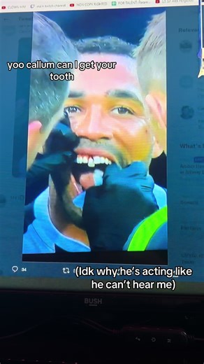 Funny Callum Wilson Tooth Request Video