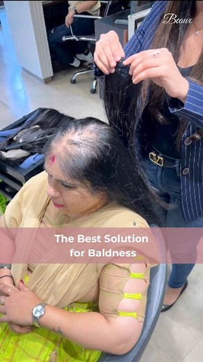 A complete hair transformation in an instant! Get full baldness coverage that also blends in easily. Beaux Backcombed Hair Filler Get a free consultation, dm us your photo or WhatsApp us on 7878664836. Shop now https://beauxhairextension.com/ hair extensions, hair topper, hair wigs, alopecia, hair thinning, affordable, baldness, bald spots, hair loss, grey hair, curls, curly hair, long hair, volume, voluminous hair #beauxhair #hairextensions #hairtopper #hairwigs #hairthinning #affordable #human
