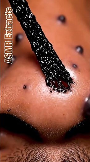 ASMR Extracts | Deep Nose Extraction
