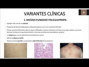 MYCOSIS FUNGOIDE, DIAGNOSIS AND PRACTICAL MANAGEMENT