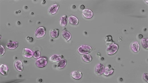 Microalgae and Humans: Unveiling the Similarities in Cellular Death Mechanisms – Archyde