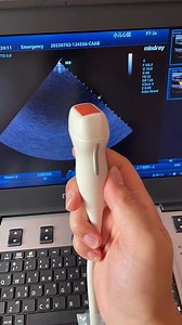 [Hot Item] Sonda de ultrasonido, transductor P7-3s para M7, M9 Mindray