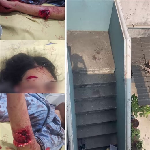 மீஞ்சூர் அருகே உள்ள வல்லூர் வாலாஜா நகரில், வீட்டில் தேர்வுக்குப் படித்துக் கொண்டிருந்த மாணவியை, கஞ்சா போதையில் வீட்டினுள் புகுந்த கும்பல், பட்டாக்கத்தியால் வெட்டி, மாணவி தற்போது ஆபத்தான நிலையில் மருத்துவமனையில் சிகிச்சை பெற்று வருகிறார் என்ற செய்தி மிகுந்த அதிர்ச்சி அளிக்கிறது. ஐந்து ஆண்டு கால திமுக ஆட்சியின் அவலம், இன்று கட்டுப்படுத்த முடியாத அளவுக்கு, போதைப் பொருள் புழக்கம் பெருகி, வீட்டிற்குள் இருக்கும் நமது குழந்தைகளுக்கே பாதுகாப்பில்லாத நிலை இன்று உருவாகியிருக்கிறது. மாணவியைத் தாக்கிய மூன்ற