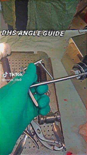 Understanding the DHS Angle Guide in Orthopedics