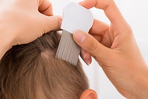 What to do If My Newborn Baby Has Lice: Natural Lice Treatment For Babies  | LiceDoctors