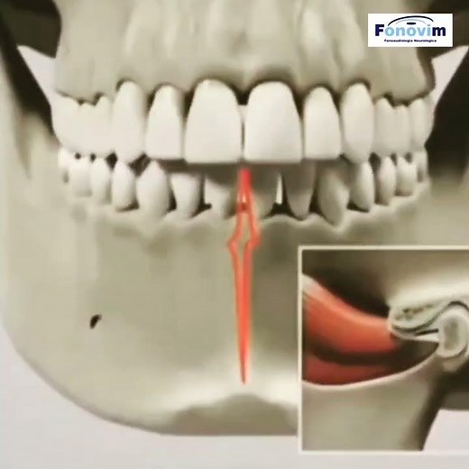 Articulação temporomandibular ATM - DTM - FONOVIM Fonoaudiologia Neurológica