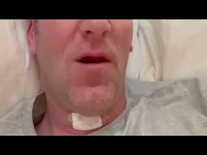 Voice Deepening/Masculinization Preop & Postop 2 months