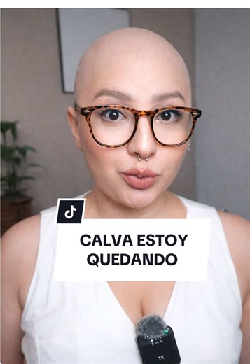 Tratamientos para la Caspa: Consejos y Productos