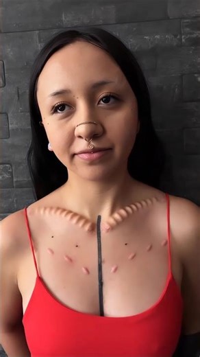 sabdermal implants more than dangerous from tattoo