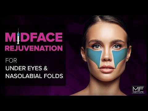 Under Eye and Midface Rejuvenation with Dermal Fillers at Mabrie Facial Institute