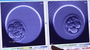 Embryo Time-Lapse Photography is Being Used as a Vital Tool for In Vitro Fertilization