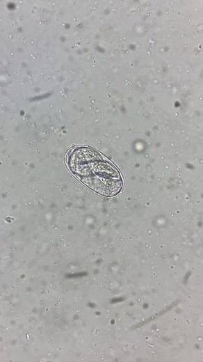 4.3K views · 59 reactions | Fecal sample  #lablife #microbiology | Lab life | Facebook