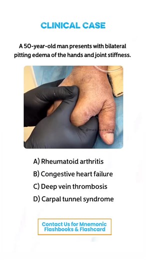 𝑴𝒆𝒅 𝑸𝒖𝒊𝒛𝒛𝒊𝒏𝒈 on Instagram: "Comment “Details” and check your inbox for the full mnemonic flashbook & flashcards! 📕✨ . . . . . . #medical #medicine #medicalstudent #medicinestudent #usmle #step1 #plab #mrcp #medicine #reels #viral #foryou #anatomy #reelexplore #instagram #neurology #nephrology #surgery #students #colleges #cardiology #knowledge #virals #plab #UK #USA #newyork #nyc #neet"