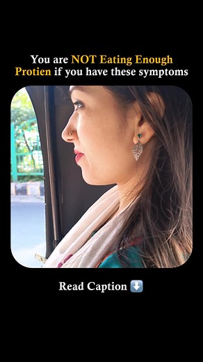 Here are some common symptoms of not getting enough protein in your diet: 1. Constant Hunger – Protein helps keep you full. Without it, you may feel hungry more often. 2. Fatigue & Low Energy – Protein is essential for energy production, so a lack can leave you feeling drained. 3. Muscle Weakness – Protein is vital for muscle repair and growth. Not enough can lead to weakness or muscle loss. 4. Hair Loss – Protein is a building block for healthy hair. Insufficient protein can cause hair thinning