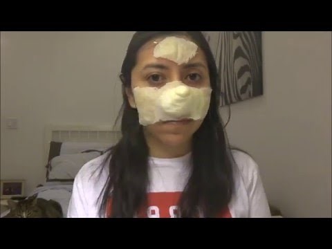 Making a Prosthetic [HOW TO]