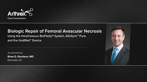 Biologic Repair of Femoral Avascular Necrosis Using the IntraOsseous BioPlasty® System, AlloSync™ Pure, and the GraftNet™ Device