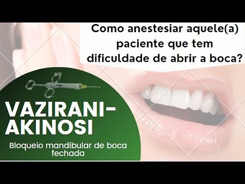Bloqueio mandibular de boca fechada (técnica de vazirani-akinosi)
