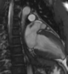 3.6K views · 52 reactions | Certified Patient Case: Chagas Disease Is...