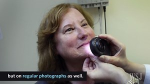 Computers Turn Medical Sleuths and Identify Skin Cancer