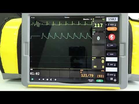 1.除細動エネルギー充電から, ショック 2. 除細動エネルギー充電から, 中止│REALITi 患者シナリオ・シミュレーター