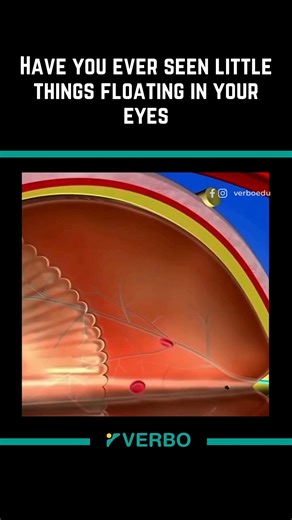 VERBO on Instagram: "Ever noticed tiny thread-like shapes drifting across your vision — especially when you stare at a bright sky or a white wall? ☁️✨ They’re not dust, and they’re not on your eyes… they’re inside them. 👀 These little floaters are actually tiny bits of gel or protein suspended in the vitreous humor — the clear, jelly-like substance that fills the inside of your eye. As light passes through, they cast faint shadows on your retina, making you see them drift and swirl when you mov