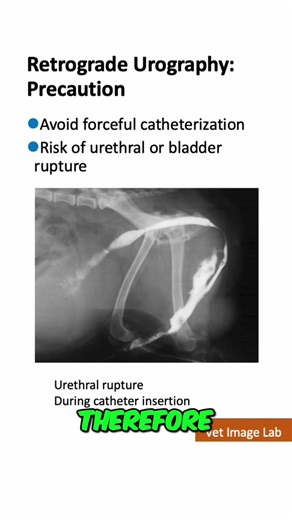 Double Contrast Study: Complications of Urethral Catheterization