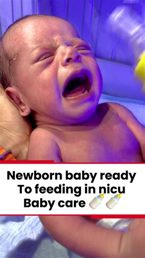 Newborn baby ready to feeding in nicu baby care 🥰🥰🍼#fyp #like #doctor #baby