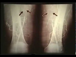 Ангиография © Angiography