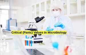 Critical (Panic) Values in Microbiology • Microbe Online