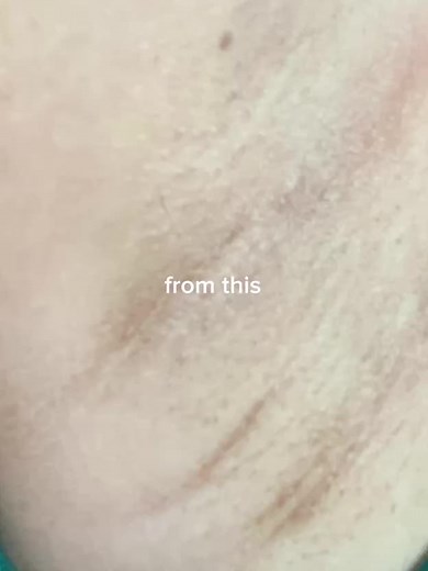 Boost Confidence with Catt & Co Underarm Serum!