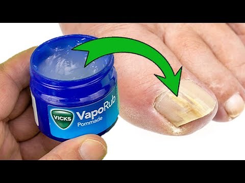 Vicks Vaporub Exposed: Unveiling the 12 Hidden Uses and Benefits