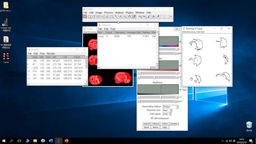 ImageJ：脑缺血体积百分比分析