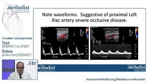 Lower Extremity Arterial Exam Interpretation and Case Examples