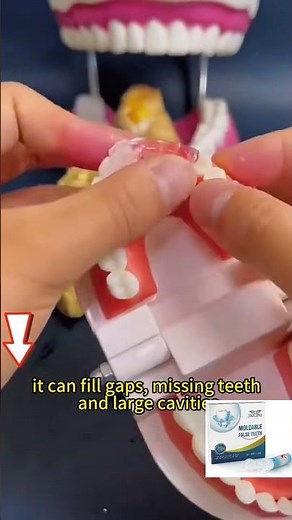 Fix broken or missing teeth fast with JXE JXO Moldable False kit temporary and easy to use! #teeth