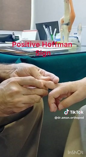 Hoffman positive sign. Cervical myelopathy. #OrthopedicCare #OrthoExpert #islamabadClinic #orthopedicsurgeon