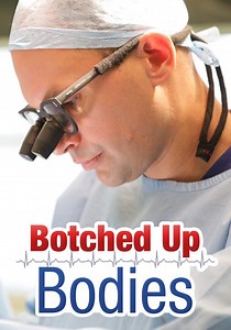 Botched Up Bodies - streaming tv show online