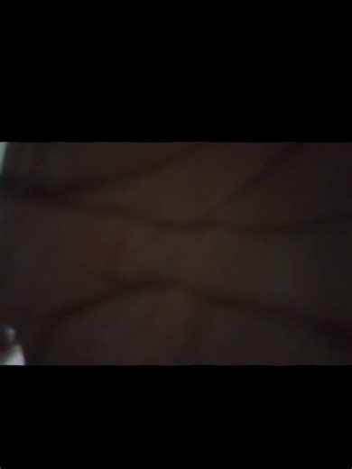 Dhakacity Hijama Service #Foryou #ViralVideo #TrendingNow #Islamic #hijamatherapy