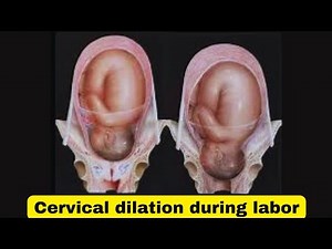 Cervical dilation how to check for labor|how to check if your cervix is dilated
