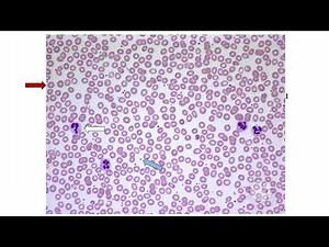 Hematology for the USMLEs: Normal Peripheral Smear Overview