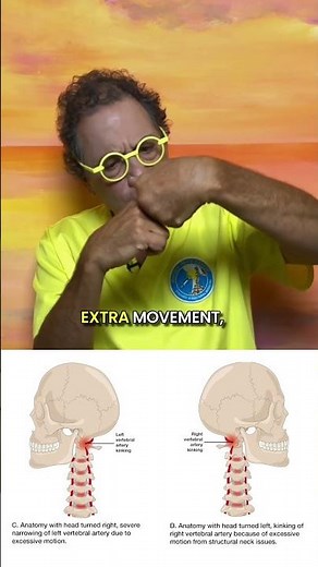 Fainting and Drop Attacks from altered blood flow to brain