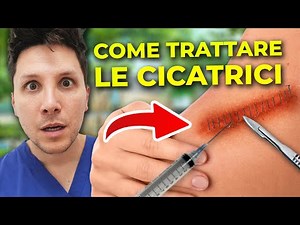 CICATRICI: Cosa sono e Come Devono essere Trattate?
